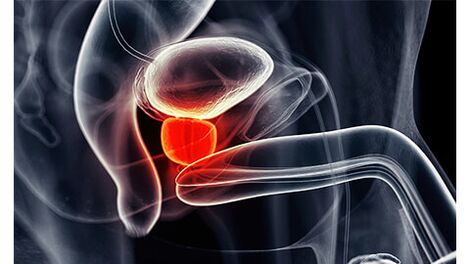 fizioterapie recenzii pentru tratamentul prostatitei prostatita aura tural