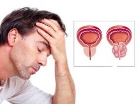 agenți etiotropi pentru prostatită